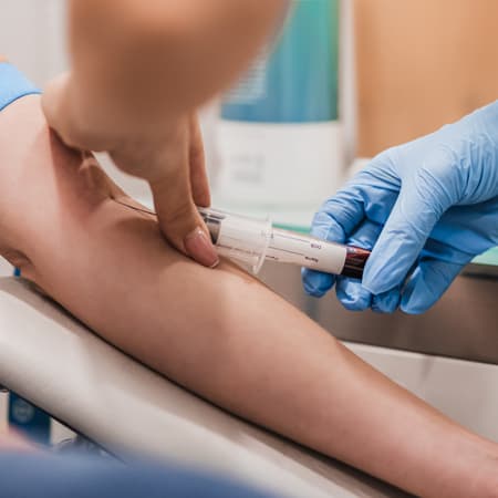 Bleeding Disorders